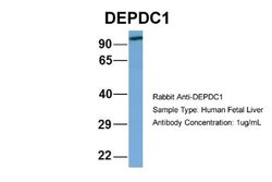 DEPDC1A Rabbit anti-Human, Polyclonal, Novus Biologicals 0.1 mL | Buy Online | Novus Biologicals | Fisher Scientific